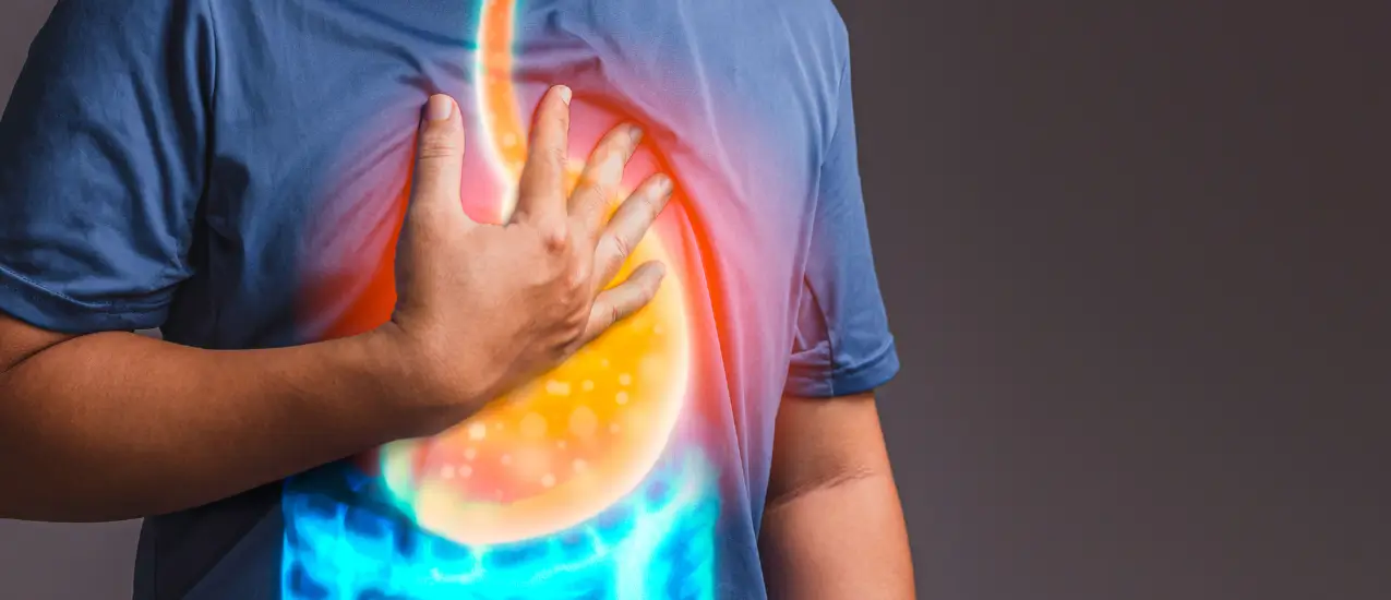 Gastroezofageálny reflux