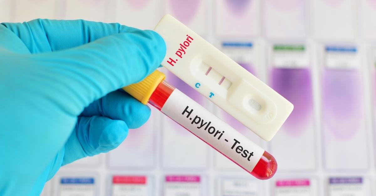 Vše co potřebujete vědět o infekci Helikobakter pylori – příznaky, strava a léčba
