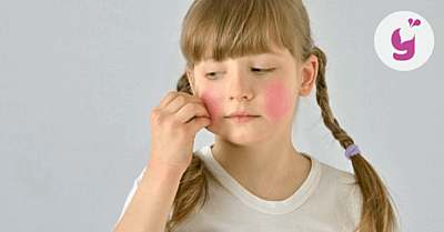 Ekzém u detí a bábätiek – čo pomáha? 