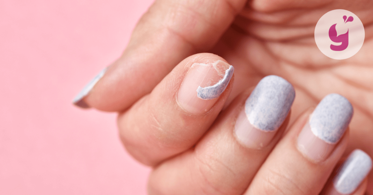 Aké sú príčiny lámavých nechtov na rukách aj nohách a čo môže pomôcť