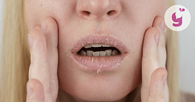 Čo na suché a popraskané pery? Príčiny a 7 účinných tipov